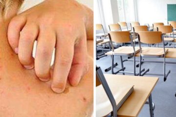 Хворий на кір — у столиці клас однієї зі шкіл відправили на карантин та дистанційне навчання