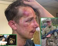 У Києві молодики побили вночі екс-військового — поліція розпочала кримінальну справу
