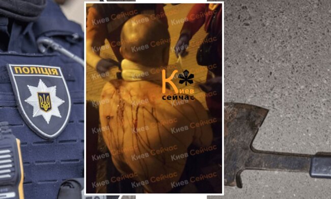 У столиці 14-річна дівчинка через побутову сварку накинулась на вітчима із сокирою