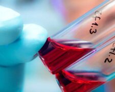 Позитивна динаміка: у Києві знижується рівень захворюваності на ВІЛ та СНІД