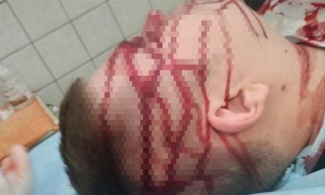 У київській лікарні №17 лікаря вдарили металевим стільцем