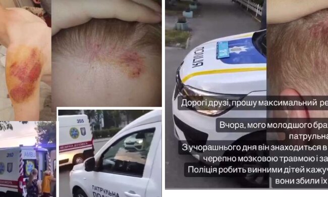ДТП за участю електросамоката та авто поліції – рідні постраждалих вбачають вину патрульних