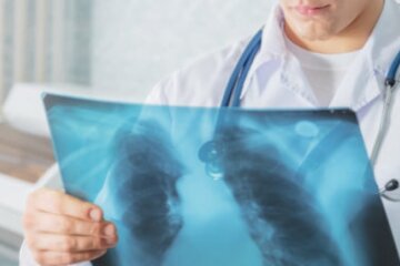 Пересувний флюорограф: де в Києві безкоштовно обстежити легені