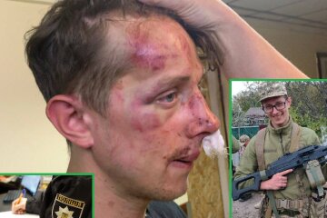 У Києві молодики побили вночі екс-військового — поліція розпочала кримінальну справу