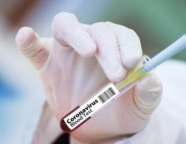 В Україні зареєстровано 6592 хворих на коронавірус, в Києві – 989: МОЗ