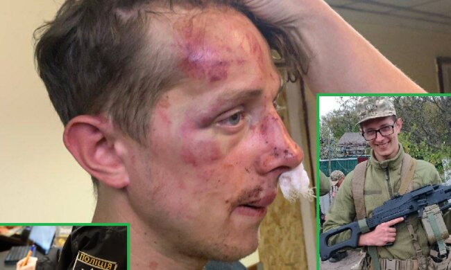 У Києві молодики побили вночі екс-військового — поліція розпочала кримінальну справу