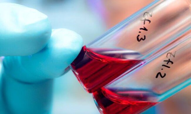 Позитивна динаміка: у Києві знижується рівень захворюваності на ВІЛ та СНІД