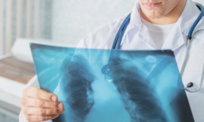 Пересувний флюорограф: де в Києві безкоштовно обстежити легені
