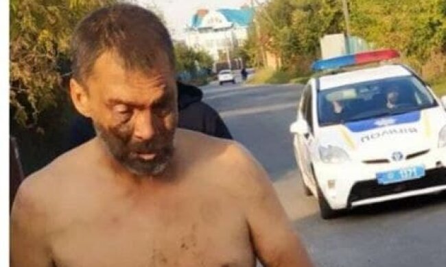 На Київщині поліцейські просять допомогти розпізнати тіло загиблого чоловіка