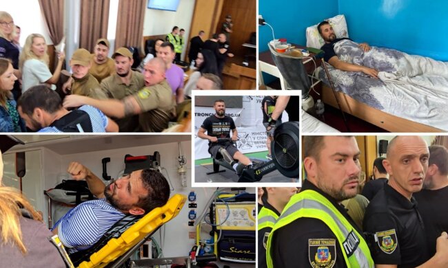 У Ірпені під час сесії міськради побили ветерана з ампутацією та протезом
