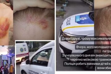 ДТП за участю електросамоката та авто поліції – рідні постраждалих вбачають вину патрульних