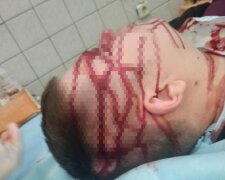 У київській лікарні №17 лікаря вдарили металевим стільцем