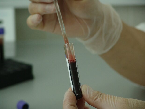 Наступного тижня в Україні стартує масове тестування на антитіла до COVID-19