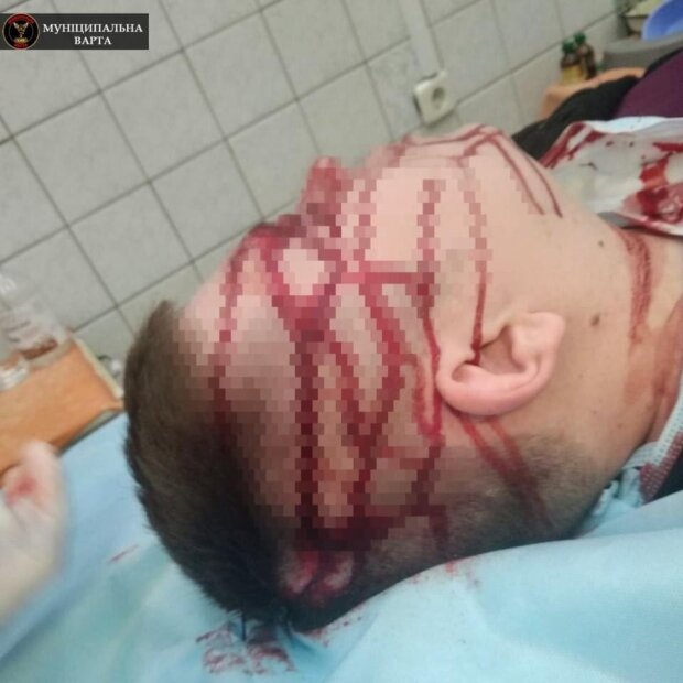 У київській лікарні №17 лікаря вдарили металевим стільцем