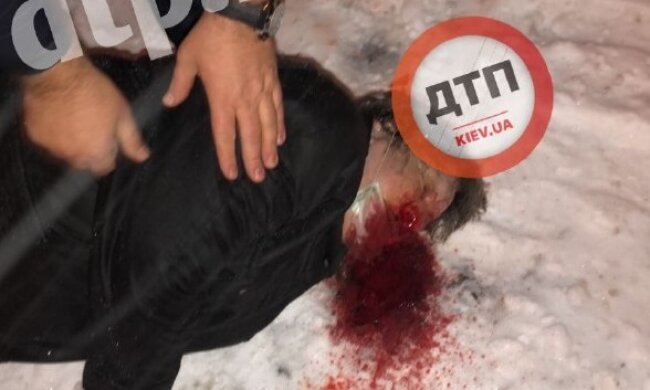 Заради забави: у Києві побили двох пенсіонерок