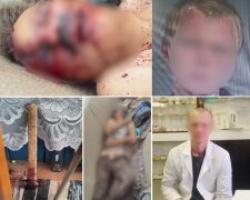 Забив молотком через образу — на Київщині молодик вбив дівчину після побачення