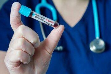 Тест-системи для виявлення коронавірусу ще перевіряються виробником, їх в країні немає: МОЗ