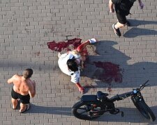 У Києві чужий пес на самовигулі розідрав жінку та її маленьку собачку